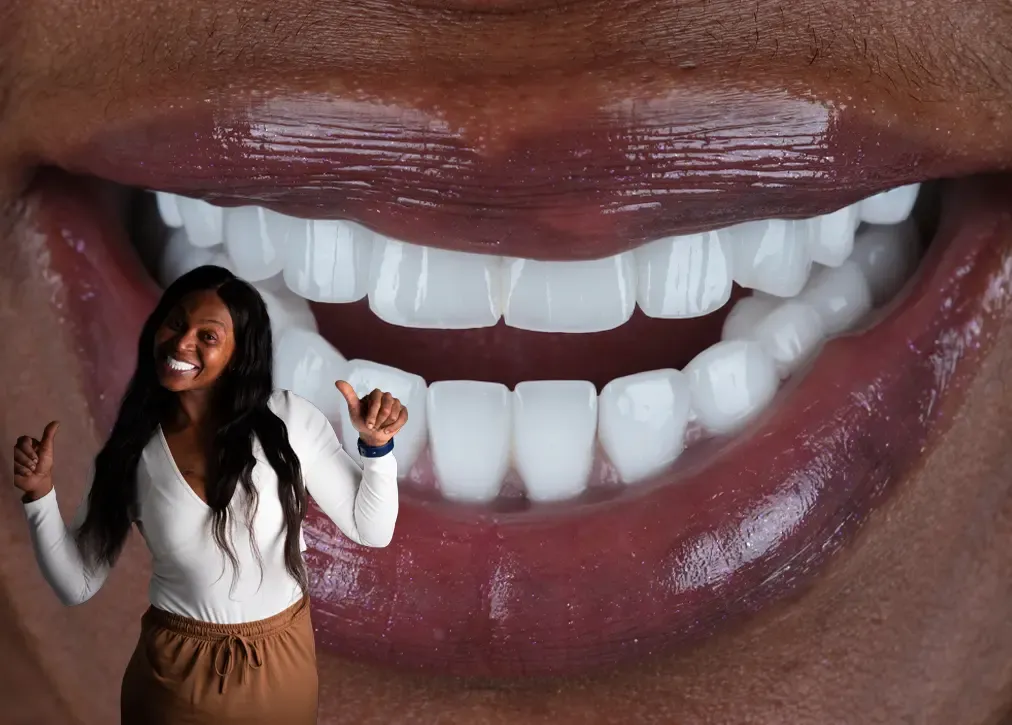 How long does laminate veneer treatment take