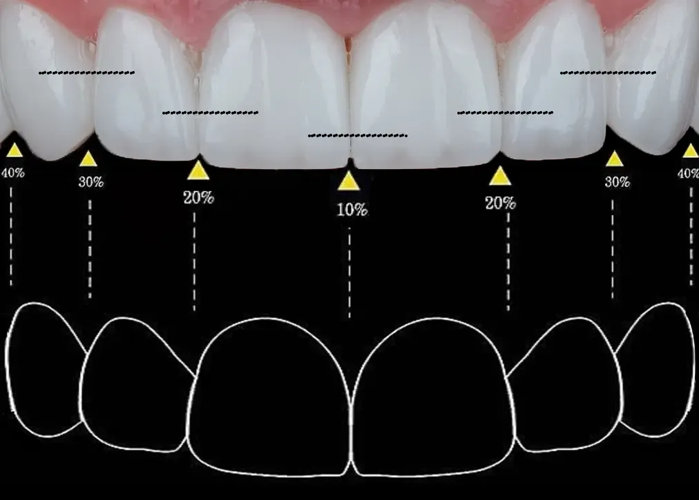 What is the hollywood smile in turkey?