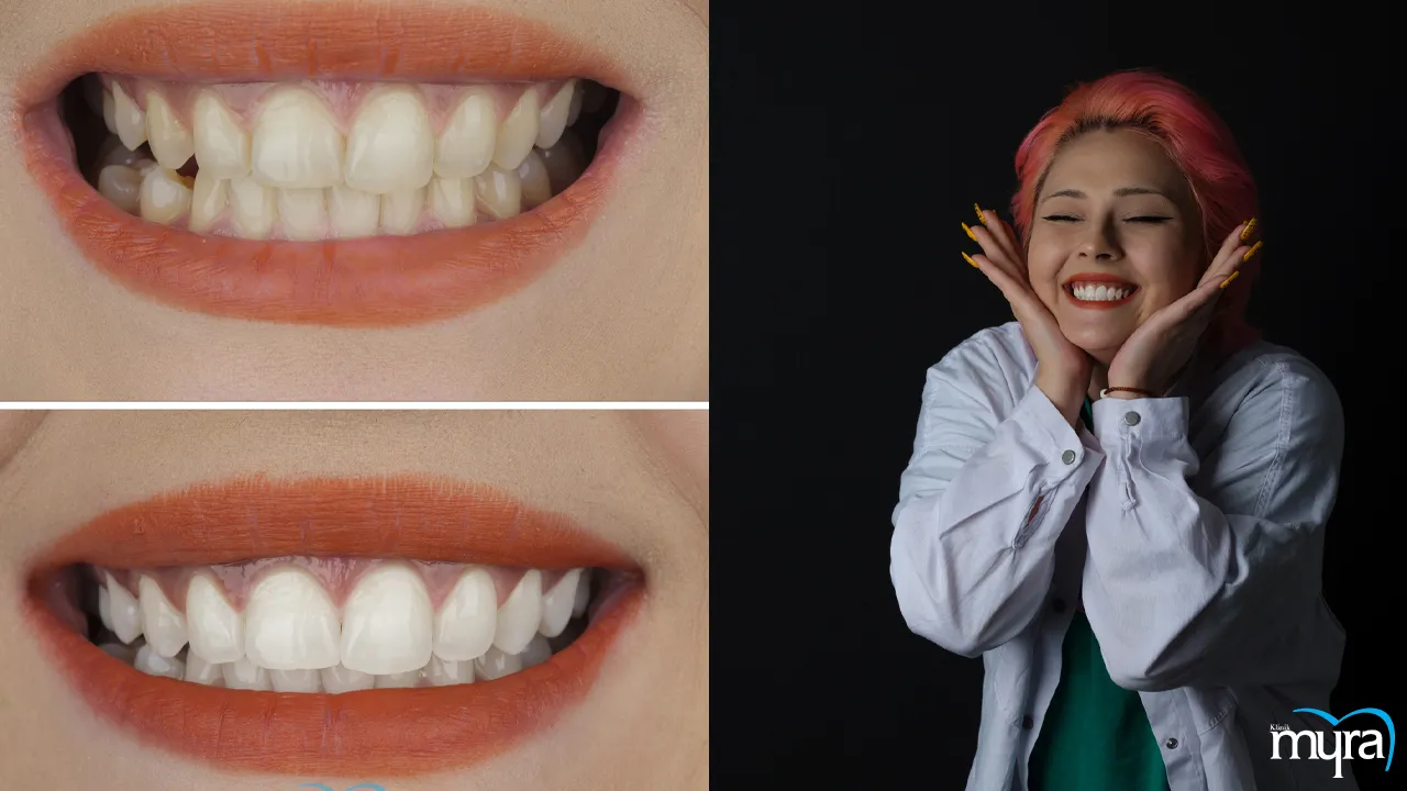 Popularity and value of dental treatments in Turkey