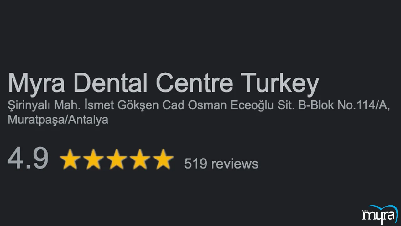 Key information about new teeth restoration with implants in Turkey