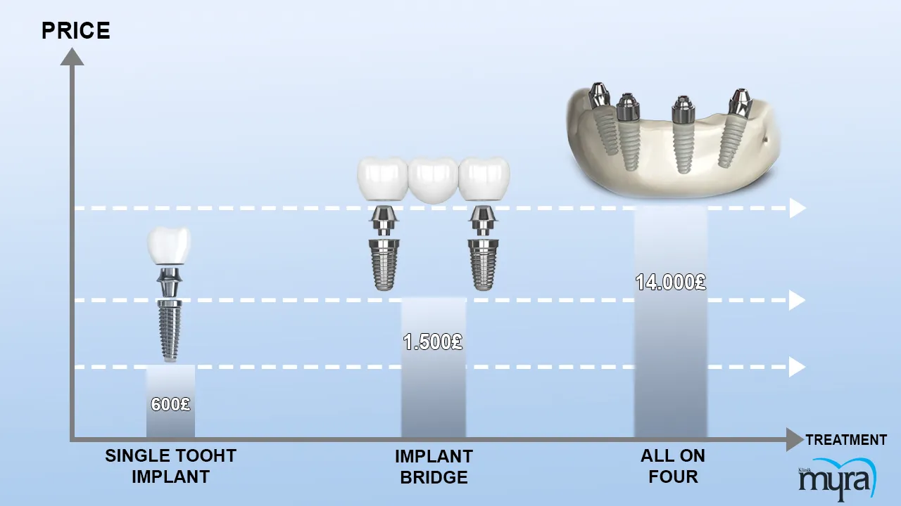 Immediate load dental implant Definition