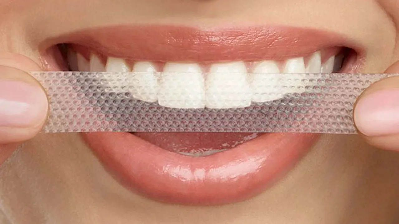 Teeth Whitening Definition