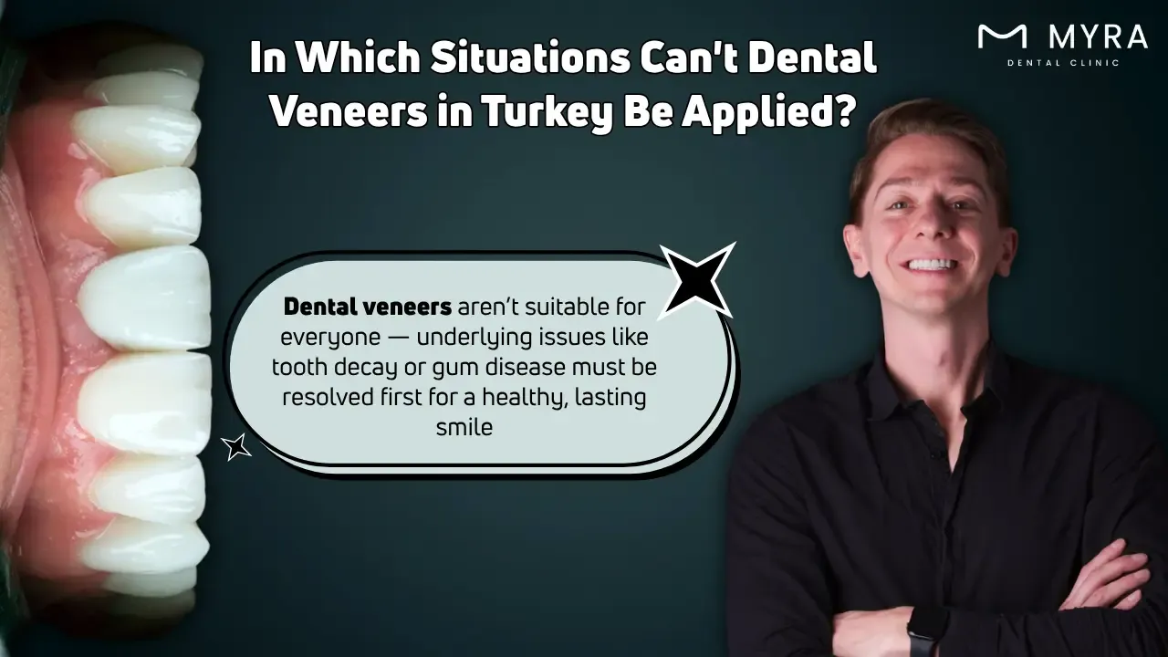 In Which Situations Can’t Dental Veneers in Turkey Be Applied