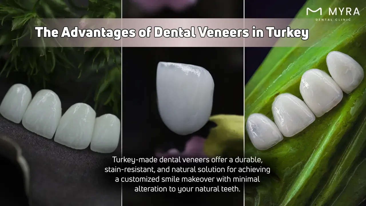 What are the Advantages of Dental Veneers in Turkey