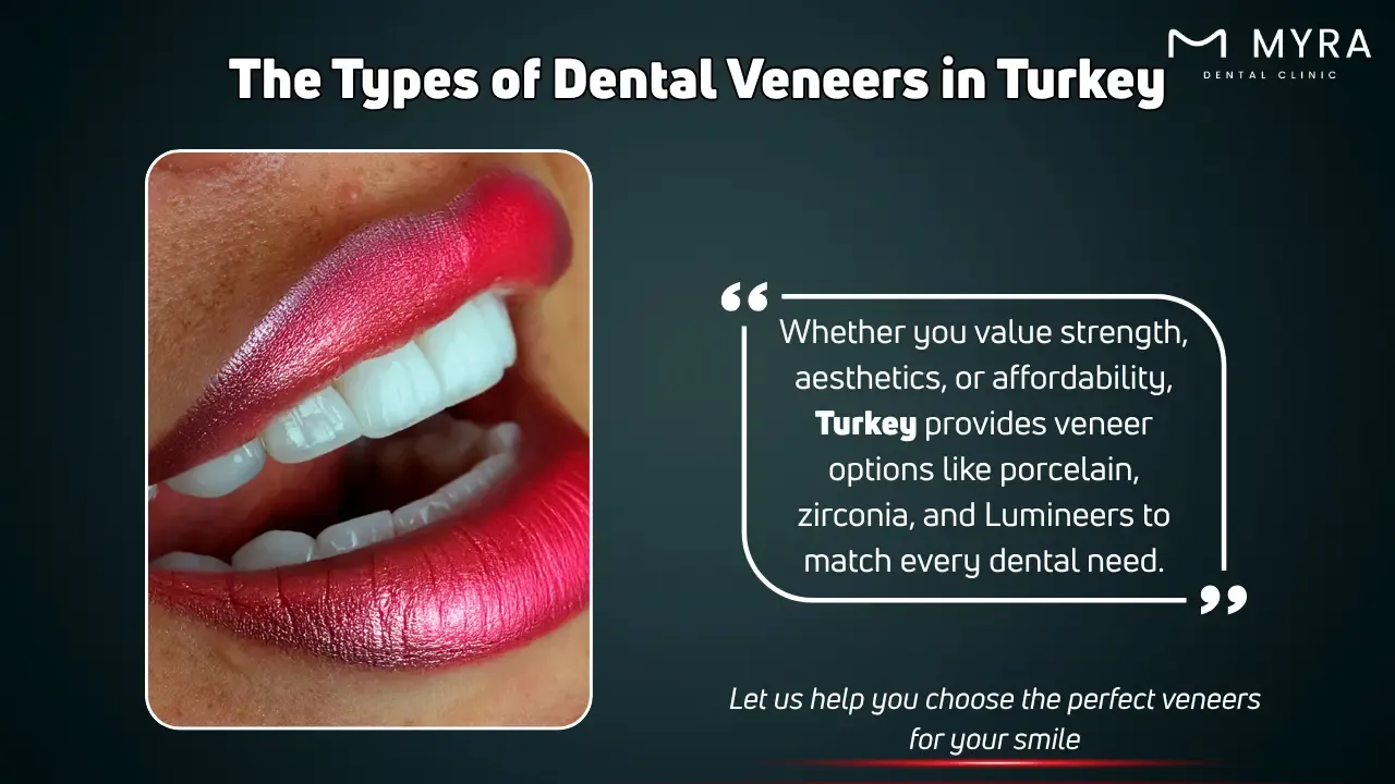 What are the Types of Dental Veneers in Turkey.