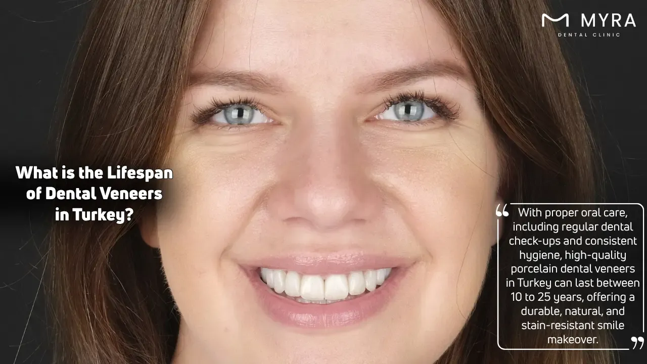 What is the Lifespan of Dental Veneers in Turkey
