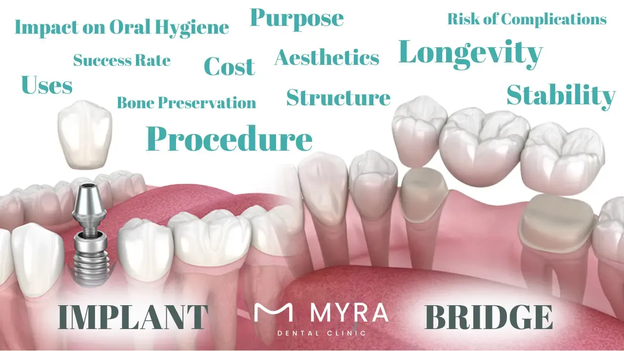What.are.the.Key.Differences.between.Dental.Implants.and.Dental.Bridges.in.turkey.webp