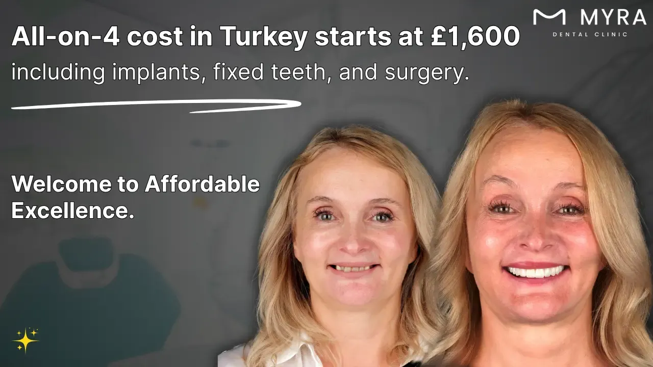 how-much-do-all-on-4-dental-implants-cost-in-turkey.webp