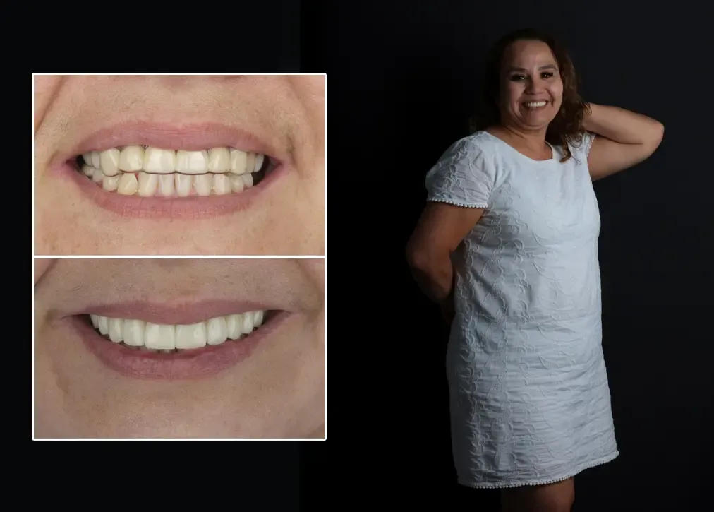 How to explain the concept of root canal treatment in turkey