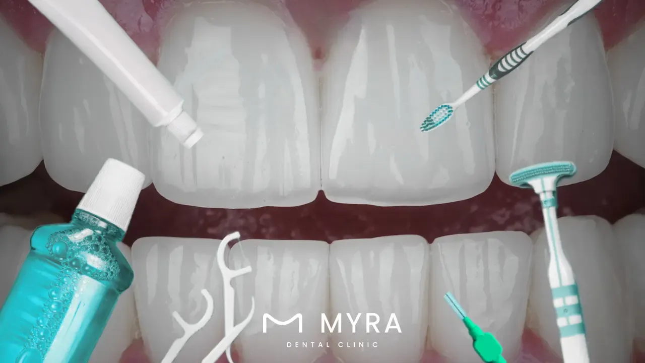 is.the.Aftercare.the.same.for.both.Dental.Bridges.and.Implants.in.turkey.webp