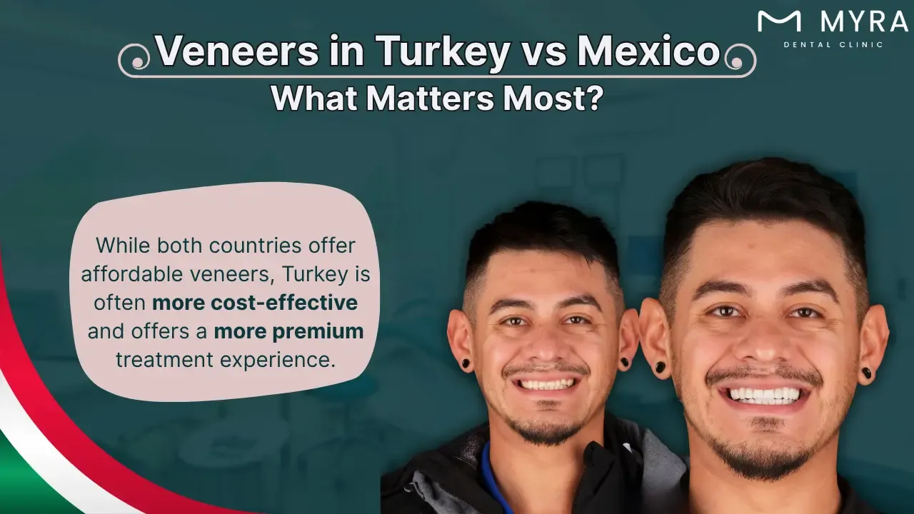 Veneers in mexico vs. turkey: Prices and considerations