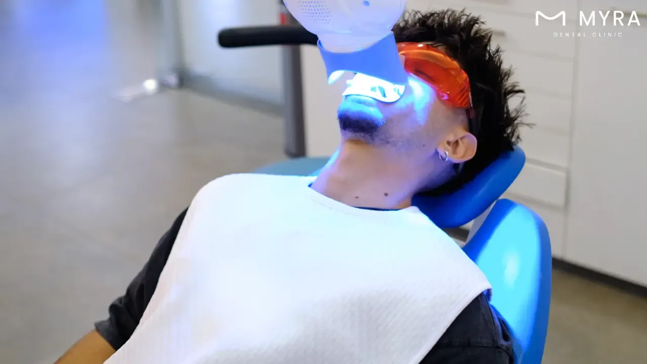 What are the treatments for stained teeth?