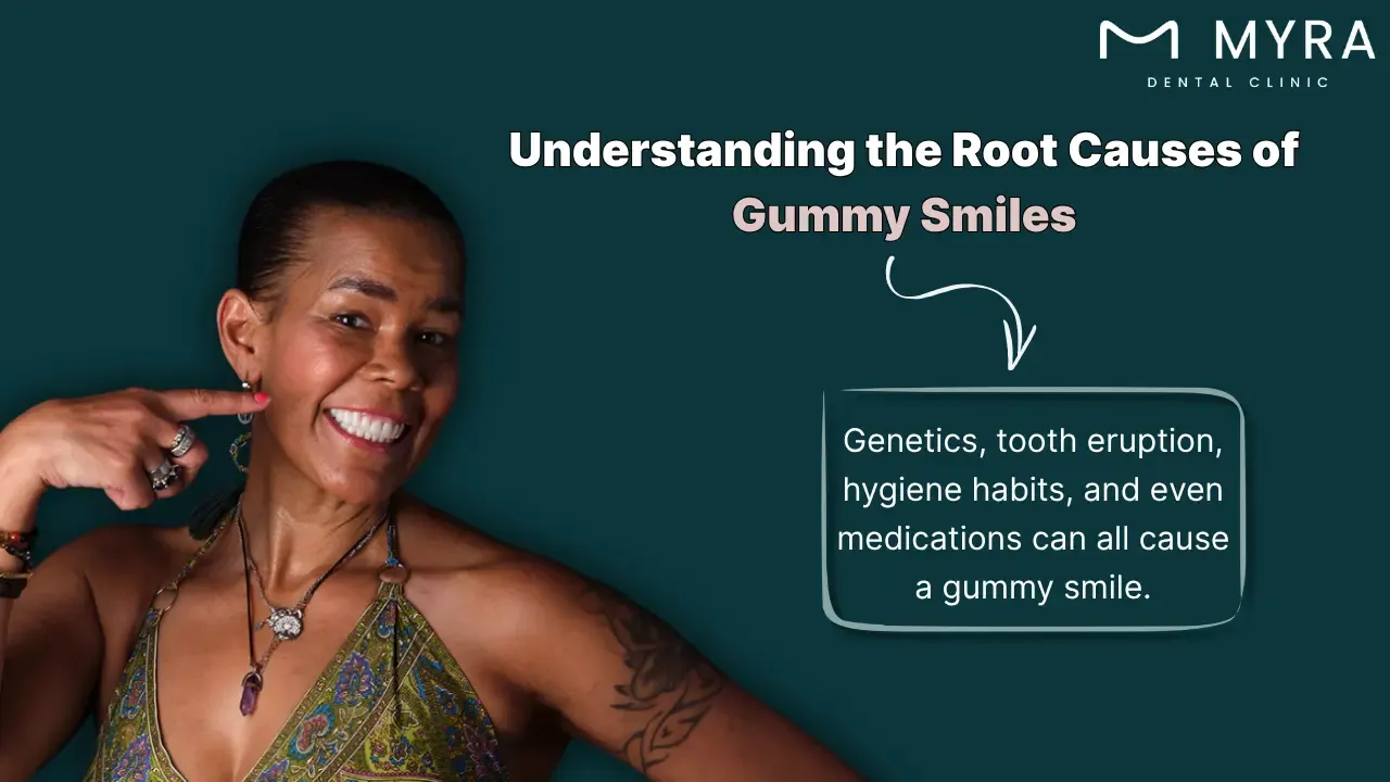 What causes a gummy smile?