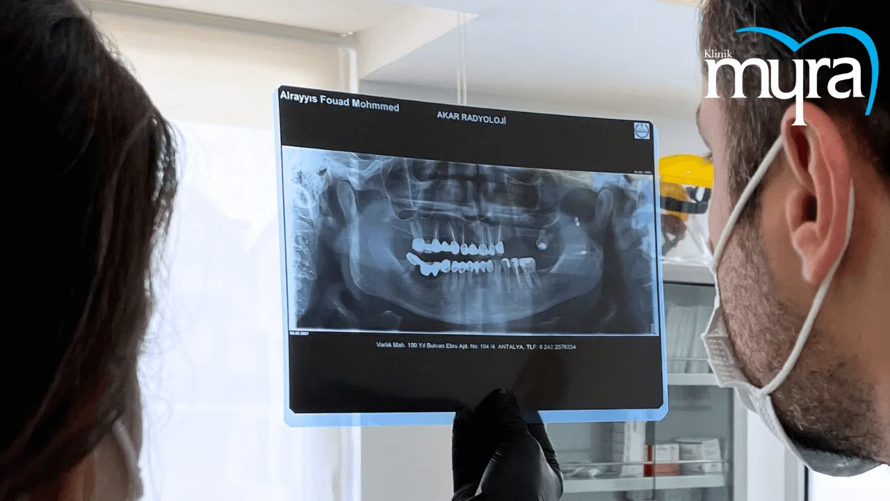 How.do.Periodontists.Diagnose.a.Tooth.in.turkey 