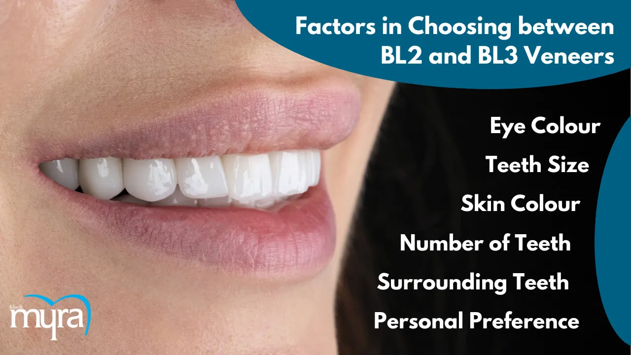 What-are-the-Factors-in-Choosing-between-BL2-and-BL3-Veneers-in-Turkey 