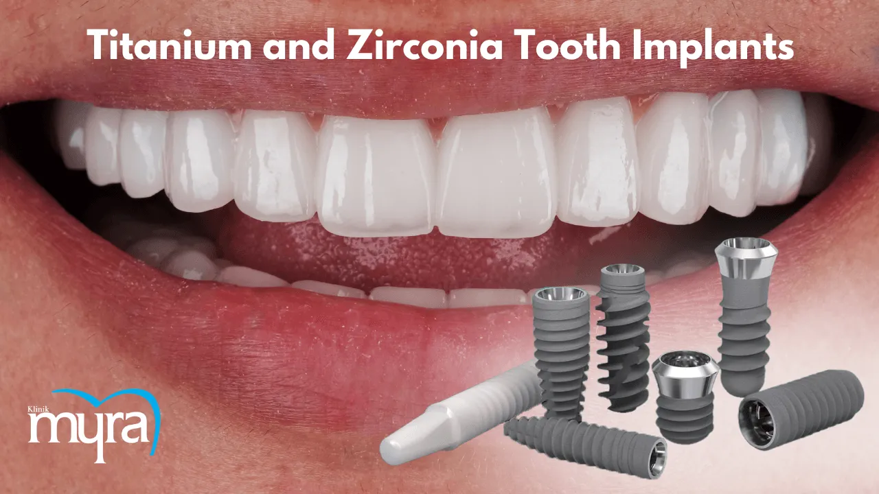 What.is.the.difference.between.Titanium.and.Zirconia.Tooth.Implants.in.turkey 