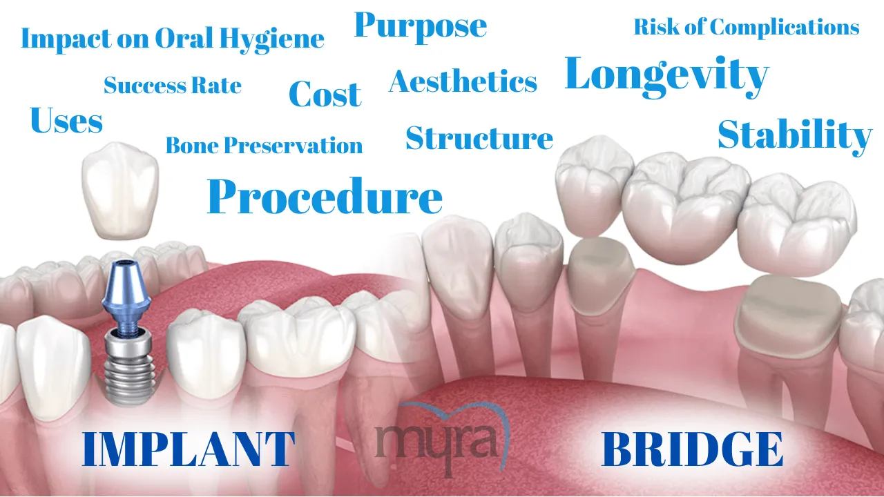 What.are.the.Key.Differences.between.Dental.Implants.and.Dental.Bridges.in.turkey 