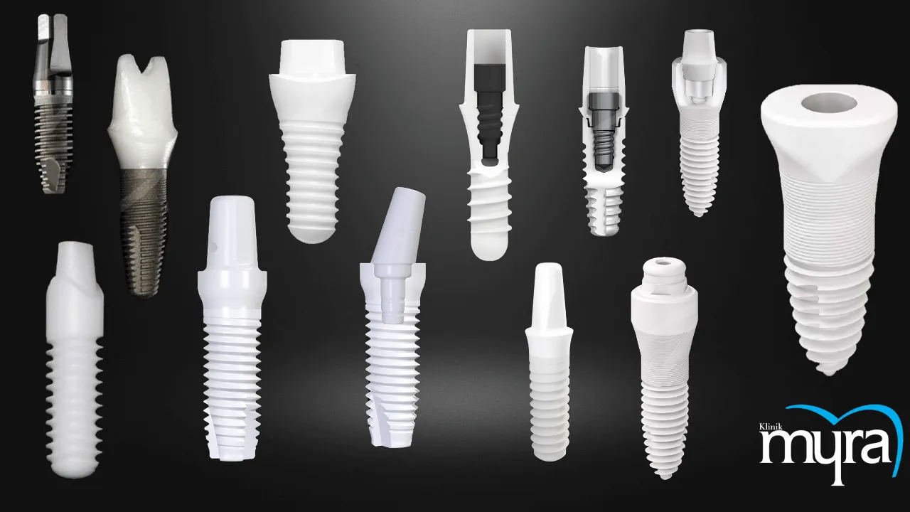 What.is.the.History.of.Zirconia.Dental.Implants.in.turkey    