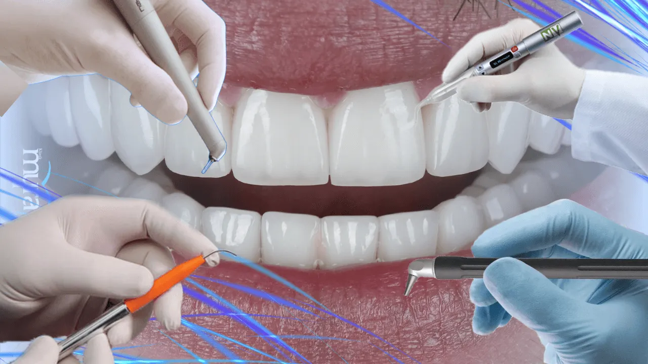 What.are.the.Types.of.Lasers.used.in.Dentistry.in.turkey 